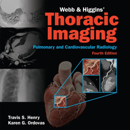 Webb  Higgins Thoracic Imaging Print  eBook with