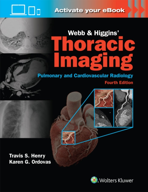 Webb  Higgins Thoracic Imaging Print  eBook with