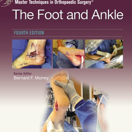 Master Techniques in Orthopaedic Surgery: The Foot and Ankle