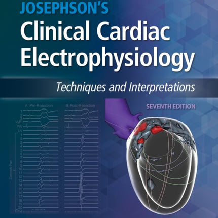 Josephson's Clinical Cardiac Electrophysiology: Techniques and Interpretations