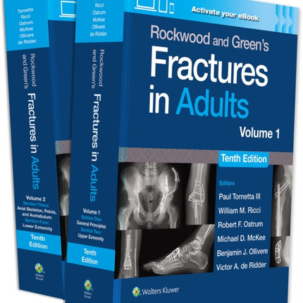 Rockwood and Greens Fractures in Adults Print  eBook with Multimedia