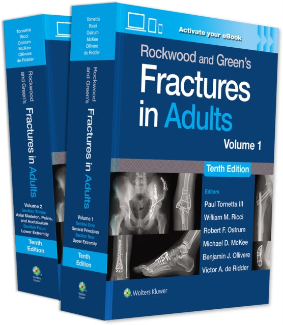 Rockwood and Greens Fractures in Adults Print  eBook with Multimedia