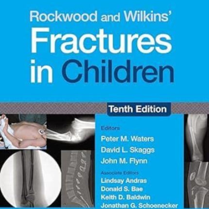 Rockwood and Wilkins Fractures in Children Print  eBook with Multimedia