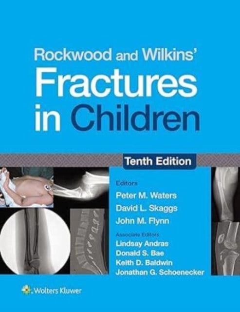 Rockwood and Wilkins Fractures in Children Print  eBook with Multimedia