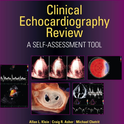 Clinical Echocardiography Review