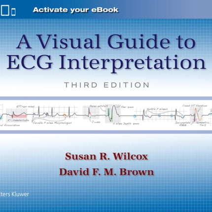 A Visual Guide to ECG Interpretation Print  eBook with Multimedia