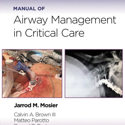 Manual of Airway Management in Critical Care Print  eBook with Multimedia