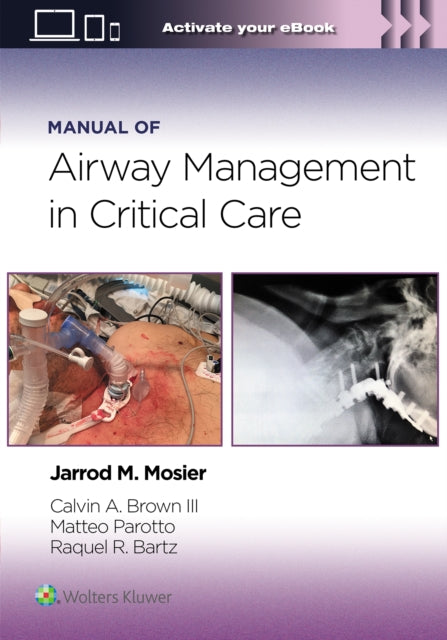 Manual of Airway Management in Critical Care Print  eBook with Multimedia