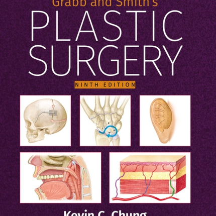 Grabb and Smiths Plastic Surgery Print  eBook with Multimedia