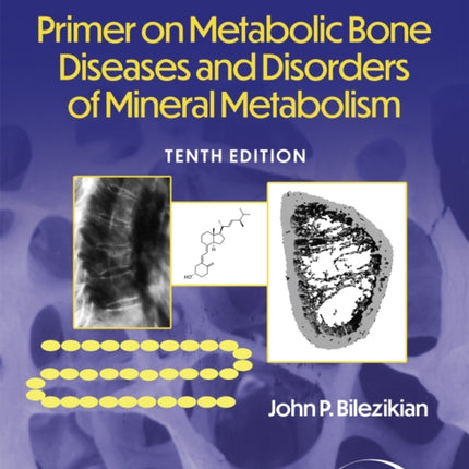 Primer on the Metabolic Bone Diseases and