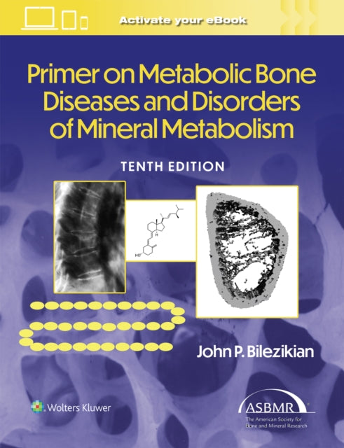 Primer on the Metabolic Bone Diseases and
