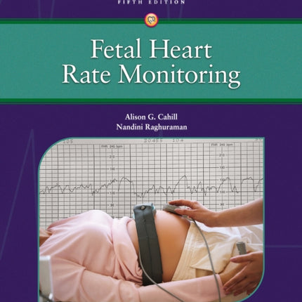 Fetal Heart Rate Monitoring