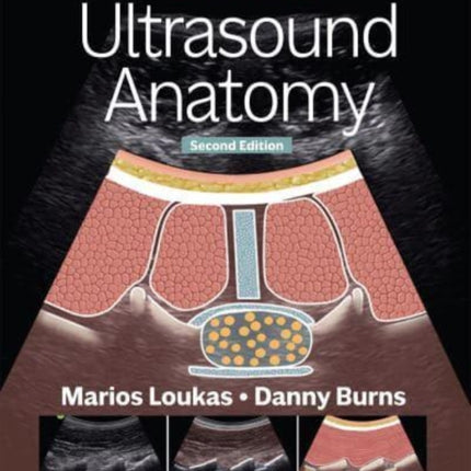 Essential Ultrasound Anatomy