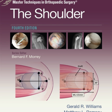 Master Techniques in Orthopaedic Surgery The