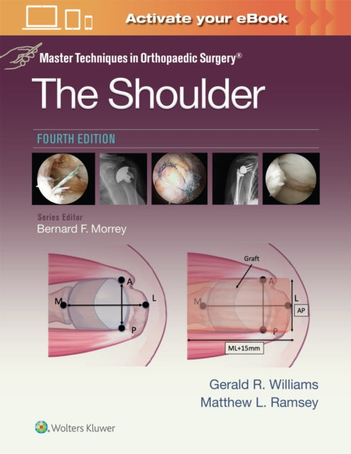 Master Techniques in Orthopaedic Surgery The