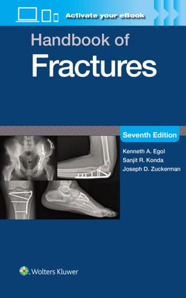 Handbook of Fractures Print  eBook with Multimedia