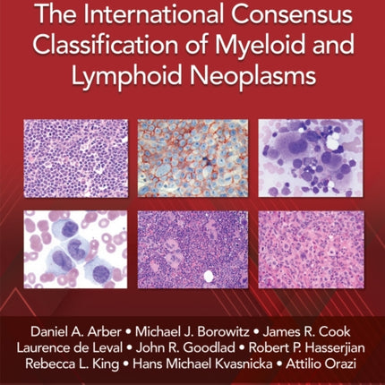 The International Consensus Classification of