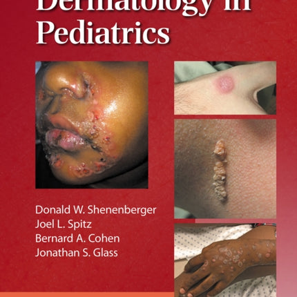 Dermatology in Pediatrics