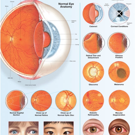 Disorders of the Eye Anatomical Chart