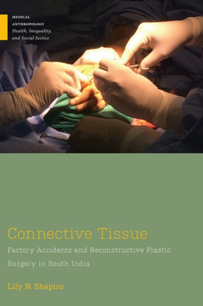 Connective Tissue  Factory Accidents and