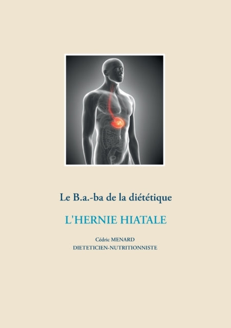 Le B.a.-ba diététique de l'hernie hiatale