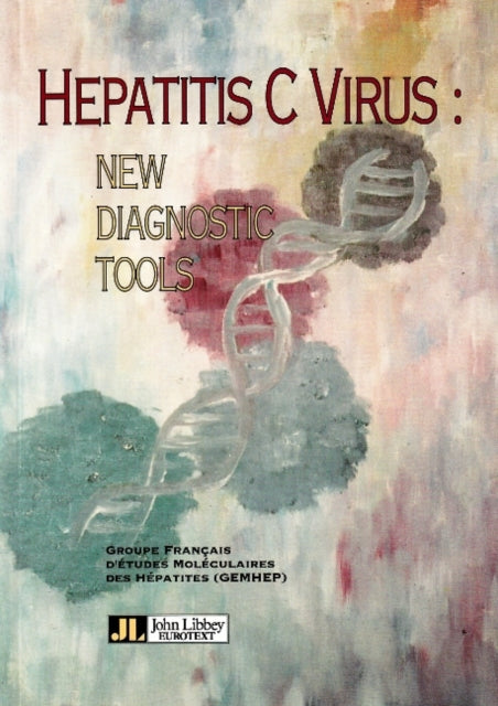 Hepatitis C Virus: New Diagnostic Tools