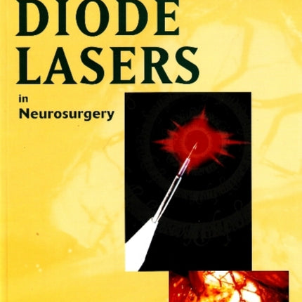 Diode Lasers in Neurosurgery