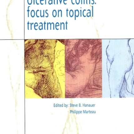 Ulcerative Colitis: Focus on Topical Treatmen