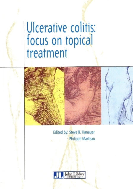 Ulcerative Colitis: Focus on Topical Treatmen