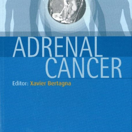 Adrenal Cancer