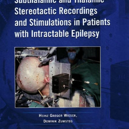 Subthalamic & Thalamic Stereotactic Recordings & Stimulations in Patients with Intractable Epilepsy