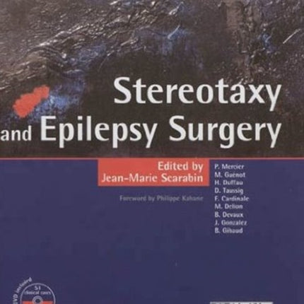 Stereotaxy  Epilepsy Surgery