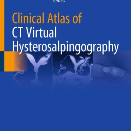 Clinical Atlas of CT Virtual Hysterosalpingography