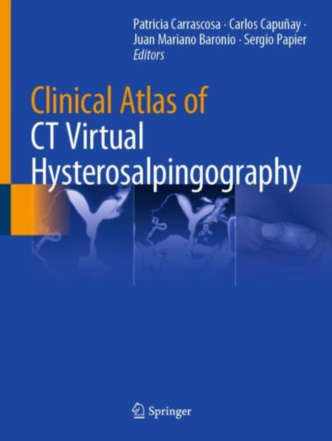 Clinical Atlas of CT Virtual Hysterosalpingography