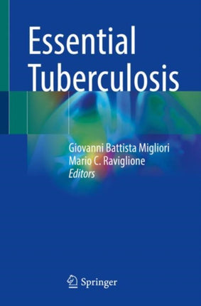 Essential Tuberculosis