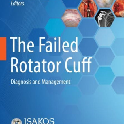 The Failed Rotator Cuff: Diagnosis and Management