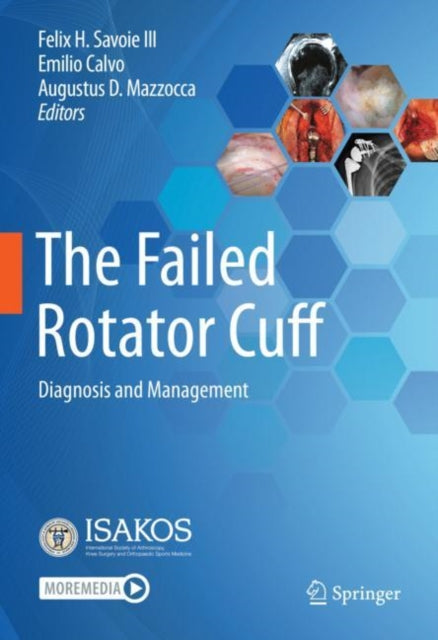 The Failed Rotator Cuff: Diagnosis and Management