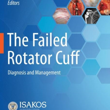 The Failed Rotator Cuff: Diagnosis and Management