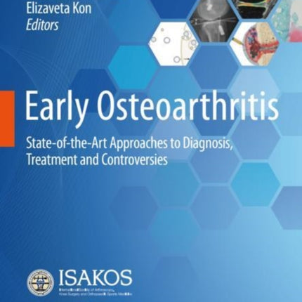 Early Osteoarthritis: State-of-the-Art Approaches