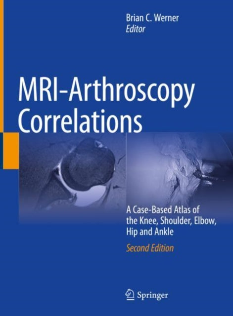 MRI-Arthroscopy Correlations: A Case-Based Atlas of the Knee, Shoulder, Elbow, Hip and Ankle