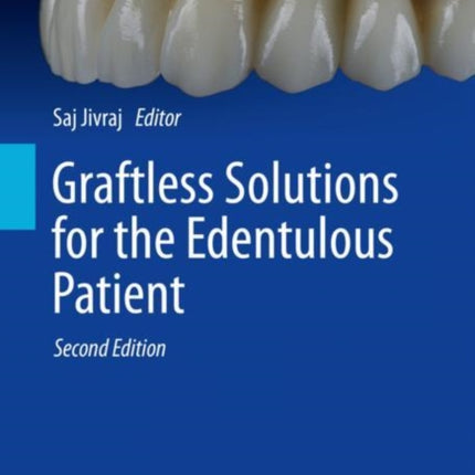 Graftless Solutions for the Edentulous Patient