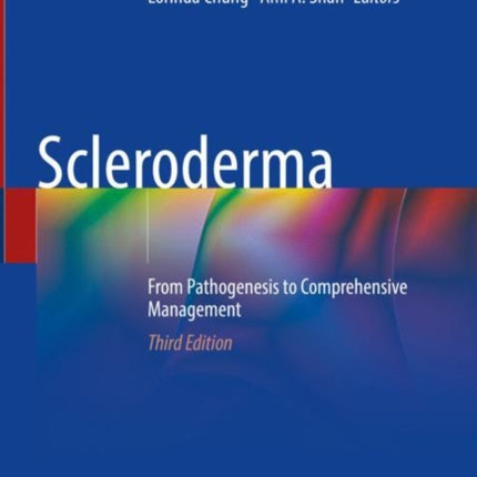 Scleroderma