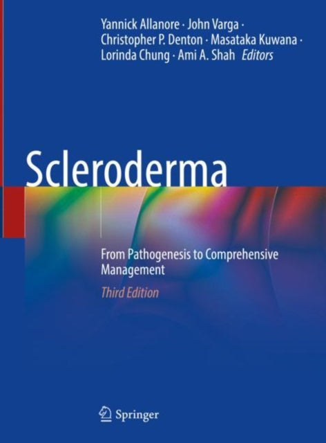 Scleroderma