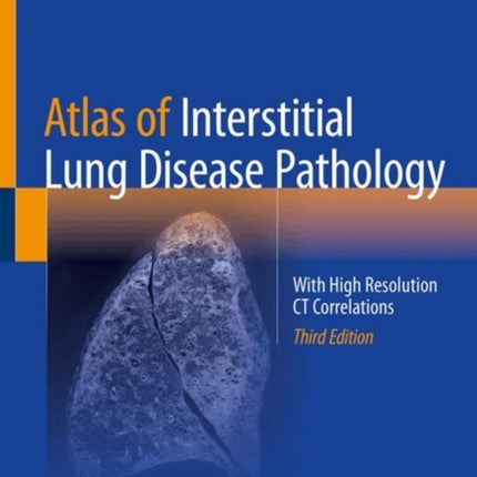 Atlas of Interstitial Lung Disease Pathology