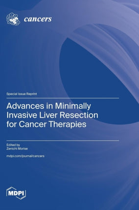 Advances in Minimally Invasive Liver Resection