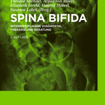 Spina bifida