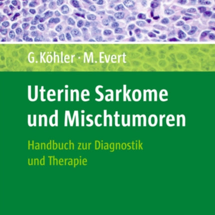 Uterine Sarkome und Mischtumoren: Handbuch und Bildatlas zur Diagnostik und Therapie