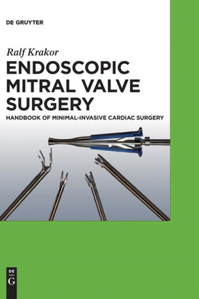 Endoscopic Mitral Valve Surgery: Handbook of Minimal-invasive Cardiac Surgery