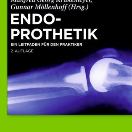 Endoprothetik