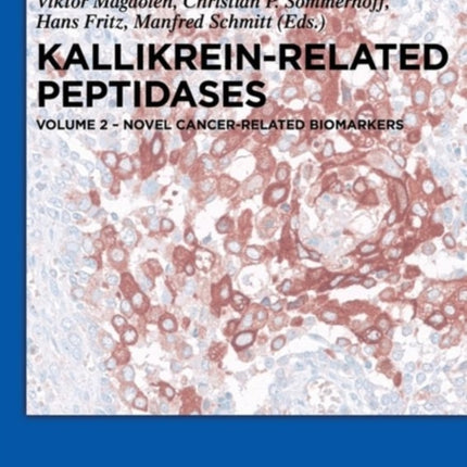 Novel cancer-related biomarkers